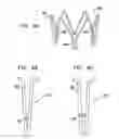 Fig. 08 - VASCULAR IMPLANT