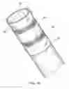 Fig. 10 - Method of treating atherosclerotic occlusive disease