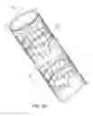Fig. 16 - Method of treating atherosclerotic occlusive disease