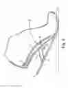 Fig. 06 - Energy return orthotic systems