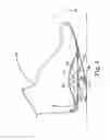 Fig. 10 - Energy return orthotic systems
