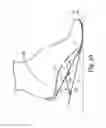 Fig. 11 - Energy return orthotic systems
