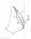 Fig. 13 - Energy return orthotic systems