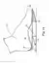Fig. 14 - Energy return orthotic systems