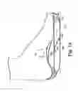 Fig. 17 - Energy return orthotic systems