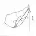 Fig. 19 - Energy return orthotic systems