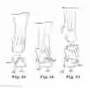 Fig. 29 - Energy return orthotic systems