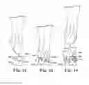 Fig. 32 - Energy return orthotic systems