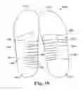 Fig. 41 - Energy return orthotic systems