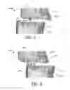 Fig. 03 - Fabrication of maxillofacial splints