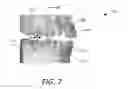 Fig. 07 - Fabrication of maxillofacial splints
