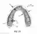Fig. 22 - Fabrication of maxillofacial splints