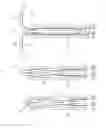 Fig. 06 - Methods for using intrauterine systems and IUD insertion devices