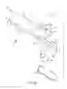 Fig. 13 - Methods for using intrauterine systems and IUD insertion devices