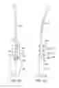 Fig. 17 - Methods for using intrauterine systems and IUD insertion devices