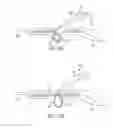 Fig. 26 - Methods for using intrauterine systems and IUD insertion devices