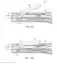 Fig. 27 - Methods for using intrauterine systems and IUD insertion devices