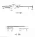 Fig. 45 - Methods for using intrauterine systems and IUD insertion devices