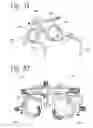 Fig. 16 - APPARATUS AND METHOD FOR CORNEAL MARKING