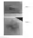 Fig. 03 - SKIN-PROTECTIVE HYDROGEL WOUND DRESSING