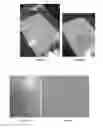 Fig. 09 - SKIN-PROTECTIVE HYDROGEL WOUND DRESSING