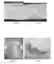 Fig. 11 - SKIN-PROTECTIVE HYDROGEL WOUND DRESSING