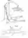 Fig. 07 - Patient repositioning sheet and sling