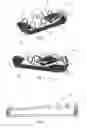 Fig. 02 - Patient isolator