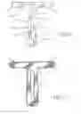Fig. 04 - Interface system in an exoskeleton