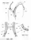 Fig. 11 - Interface system in an exoskeleton