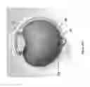 Fig. 56 - Implants with controlled drug delivery features and methods of using same
