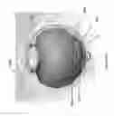Fig. 57 - Implants with controlled drug delivery features and methods of using same