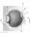 Fig. 58 - Implants with controlled drug delivery features and methods of using same