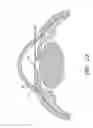 Fig. 60 - Implants with controlled drug delivery features and methods of using same