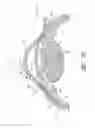 Fig. 61 - Implants with controlled drug delivery features and methods of using same