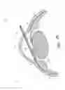 Fig. 63 - Implants with controlled drug delivery features and methods of using same