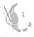 Fig. 65 - Implants with controlled drug delivery features and methods of using same