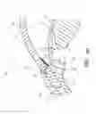 Fig. 70 - Implants with controlled drug delivery features and methods of using same