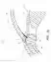 Fig. 71 - Implants with controlled drug delivery features and methods of using same