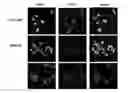 Fig. 01 - CANCERS EXPRESSING CCR5 AND METHODS OF TREATMENT OF SAME