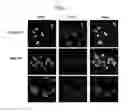 Fig. 02 - CANCERS EXPRESSING CCR5 AND METHODS OF TREATMENT OF SAME