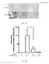 Fig. 02 - Method of preventing or treating osteoporosis by neddylation inhibitor