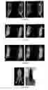 Fig. 07 - PSMA binding ligand-linker conjugates and methods for using