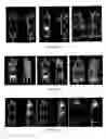 Fig. 08 - PSMA binding ligand-linker conjugates and methods for using