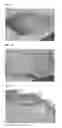 Fig. 02 - COMPOSITIONS AND METHODS FOR HEALING WOUNDS