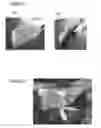 Fig. 09 - Haemostatic device