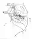 Fig. 08 - Fluid control and bypass features for an apheresis system