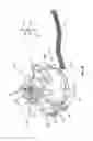 Fig. 09 - Fluid control and bypass features for an apheresis system