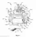 Fig. 10 - Fluid control and bypass features for an apheresis system