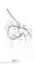 Fig. 04 - Respiratory mask